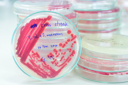red colony in petridish in microbiology laboratory test