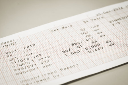 electrocardiogram with vintage style