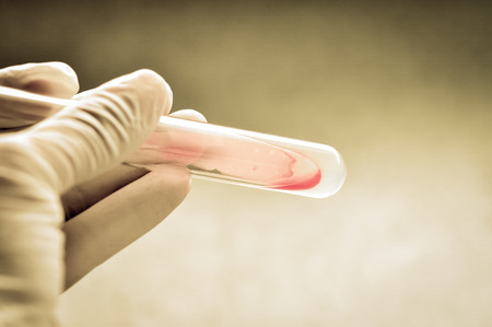 microbiology laboratory test with old color styleの写真素材