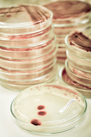 microbiology laboratory test with old color styleの写真素材