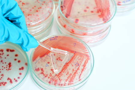 microbiology laboratory test with red colony of bacteriaの写真素材