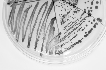 colony of becteria in petridish in microbiology laboratory with black and white conceptの写真素材