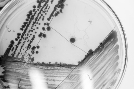 bacteria colony in petridish with black and white colourの写真素材