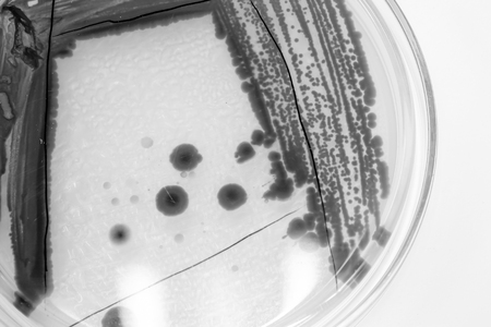 bacteria colony in petridish with black and white colourの写真素材