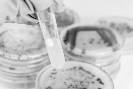 fungi colony in test tube with black and white colourの写真素材