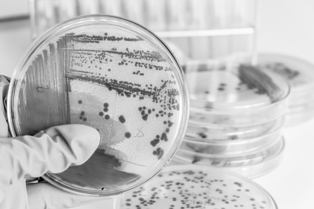 bacteria colony in petridish with black and white colourの写真素材