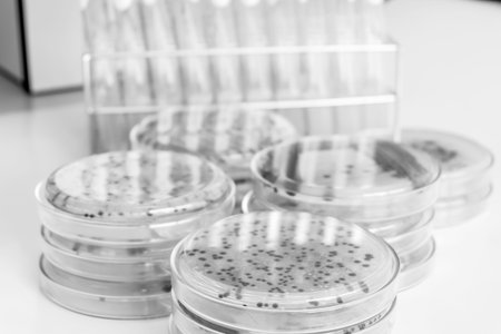 bacteria colony in petridish with black and white colour