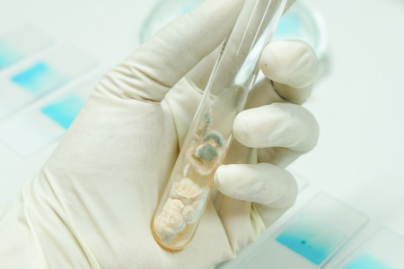 fungi colony in test tubeの写真素材