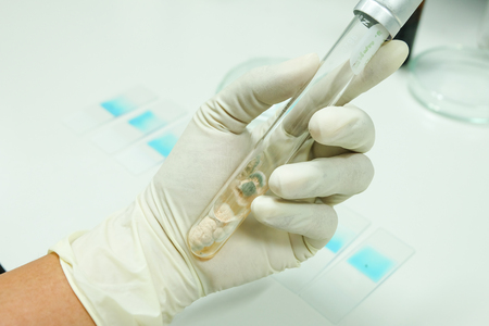 fungi colony in test tubeの写真素材