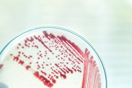 bacteria colony in petridish