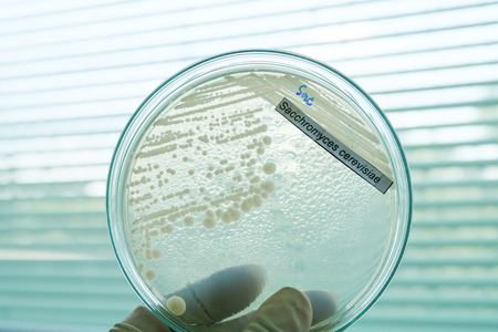 bacteria colony in petridishの写真素材