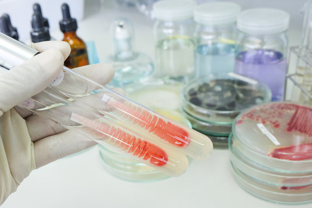 bacteria colony in test tubeの写真素材