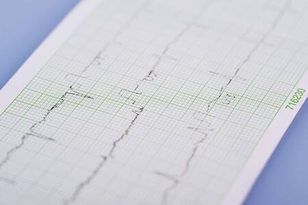 EKG, electrical activity of the heart in close upの写真素材