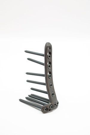 A Surgical implant for tibial plateau fixation, showcasing precision engineering and durability
