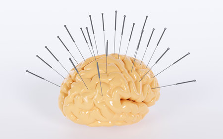 3D rendering of a human brain with acupuncture needles on color background, acupuncture treatment, Chinese traditional alternative medicineの写真素材