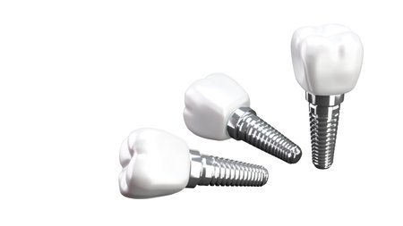 3D rendering of tooth implants with ceramic crowns on a white background, Modern dental surgery conceptの写真素材