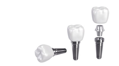 3D rendering of tooth implants with ceramic crowns on a white background, Modern dental surgery conceptの写真素材
