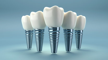 3D rendering of tooth implants with ceramic crowns on color background, Modern dental surgery conceptの写真素材