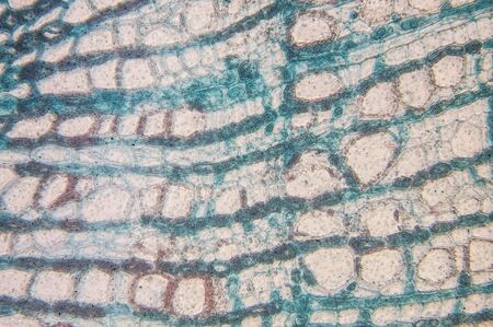 Structure and properties of cambial cells - observation in the microscope
