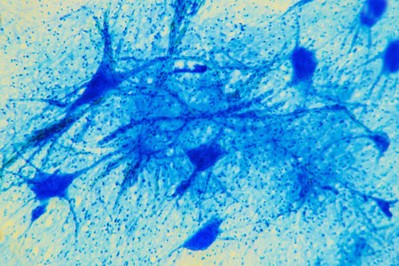 Science background- neuron tissue. Nerve fibers: motor neurous- study with a large increase in the...