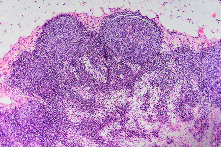 Cell lymph node dog. Micro preparations used for the care and treatment of animals. Scientific research methodology.の写真素材