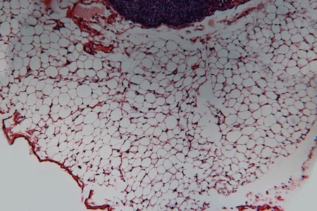 Animal cell- lymph node dog. Photo macro sections with high magnification with light microscope. Large format.の写真素材