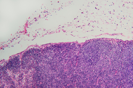 Nature background. Dog lymph node- lymphadenitis (inflammation). Learning and teaching school biology prepared microscope slidesの写真素材