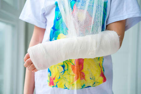 Close-up of a broken arm of a child in a cast. The girl holds her hand folded against the background of a multi-colored T-shirt. A child with a plaster on his handの写真素材