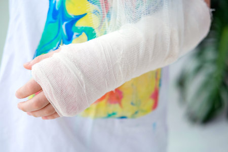 Close-up of a broken arm of a child in a cast. The girl holds her hand folded against the background of a multi-colored T-shirt.A child with a plaster on his handの写真素材