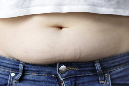 A excess fat on the abdomen close up, the concept of weight lossの写真素材