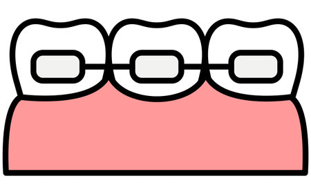 Dentistry: Orthodontic appliances and metal brackets used to straighten teeth, Vector Illustrationのイラスト素材