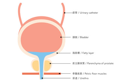 Medical Illustration of the Prostate, Prostate and Bladder, Vector Illustration