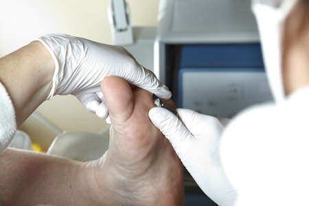 A PODIATRIST WORKS WITH A SCALPELの写真素材