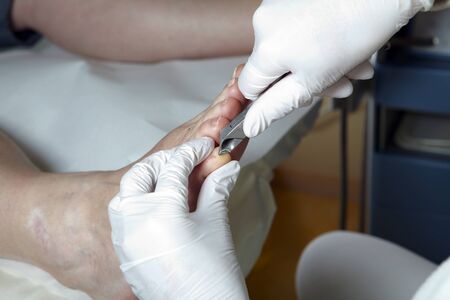 A Podiatrist cut the toenails on of a womenの写真素材