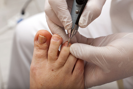 A chiropodist taking care of womanの写真素材