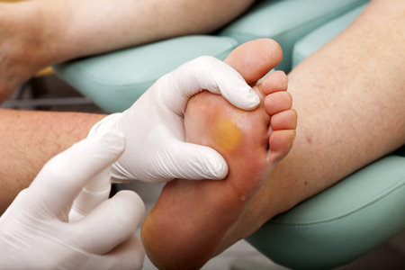 Chiropodists sprays and cleans the foot of a woman