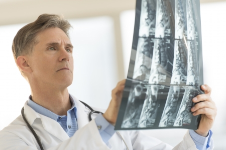 Mature male doctor analyzing X-ray report in clinicの写真素材