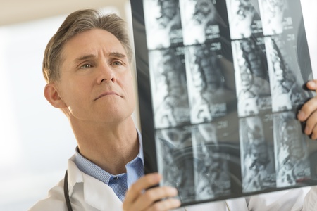 Close-up of mature male doctor examining X-ray report in clinicの写真素材