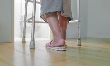 Elderly swollen feet or edema leg walk into bathroom