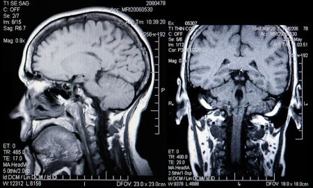 Dual View of Real MRI Scans of the Head and Brain