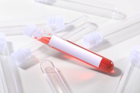 Pandemic Style Blood Testing Tubes on White With Labelの写真素材