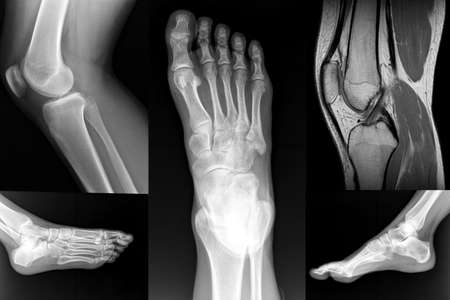 Orthopedic Collage of Foot and Knee XRayの写真素材