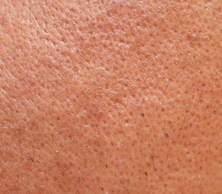 pores and oily on surface young asian man face skin do not take care for a long timeの写真素材