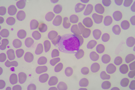 Blood smearの写真素材