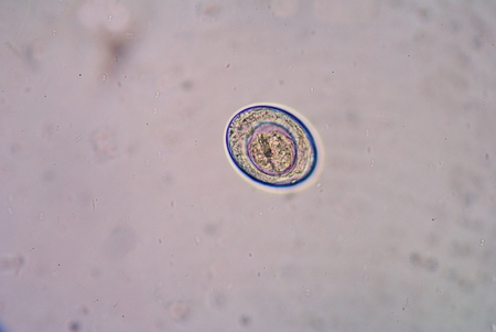 Hymenolepis nana, previously known as Vampirolepis nana, Hymenolepis fraterna, and Taenia nana