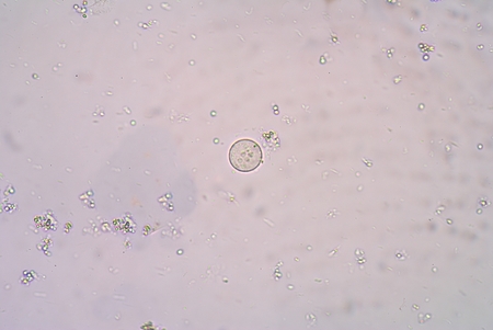 Protozoa in stool exam