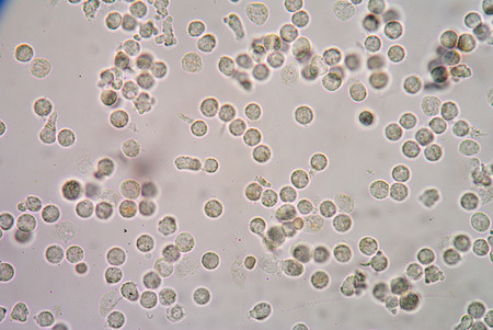 White blood cells of a human, photomicrograph panorama as seen under the microscope, 1000x zoom.の写真素材