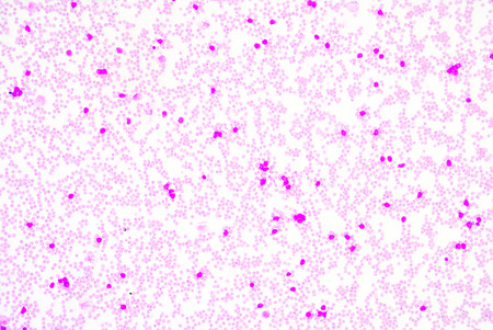 White blood cells of a human, photomicrograph panorama as seen under the microscopeの写真素材