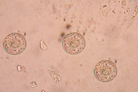 Taenia is a genus of tapeworm (a type of helminth) that includes some important parasites of...