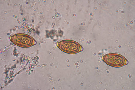 The human whipworm (Trichuris trichiura or Trichocephalus trichiuris) is a round worm (a type of...